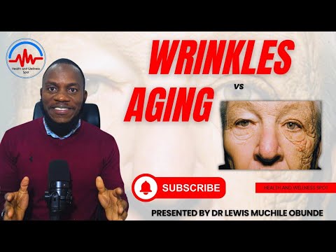 𝐖𝐑𝐈𝐍𝐊𝐋𝐄𝐒 𝐕𝐒 𝐀𝐆𝐈𝐍𝐆